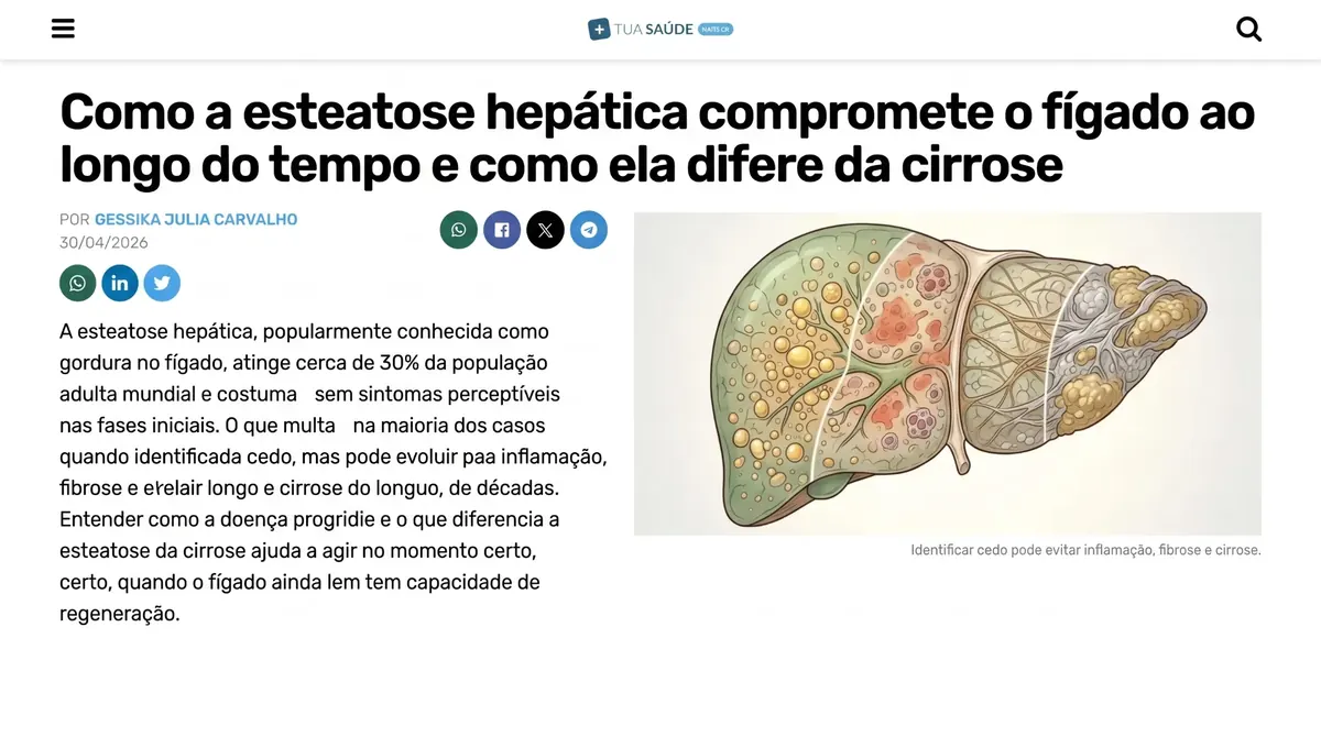Print da matéria: Como a esteatose hepática compromete o fígado ao longo do tempo e como ela difere da cirrose